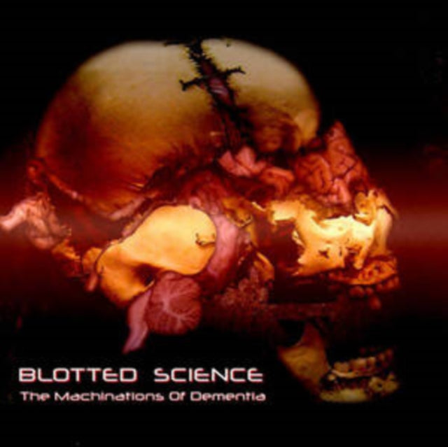 This LP Vinyl is brand new.Format: LP VinylMusic Style: Death MetalThis item's title is: Machinations Of DementiaArtist: Blotted ScienceLabel: Alone Records (2)Barcode: 8436566652698Release Date: 12/13/2024